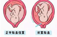 2026山东省特需排名是怎么样的？附深圳特需试管机构推荐